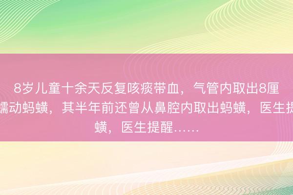 8岁儿童十余天反复咳痰带血，气管内取出8厘米活体蠕动蚂蟥，其半年前还曾从鼻腔内取出蚂蟥，医生提醒……